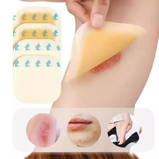 Ultra-thin Hydrocolloid Dressing Wound Regeneration Medical